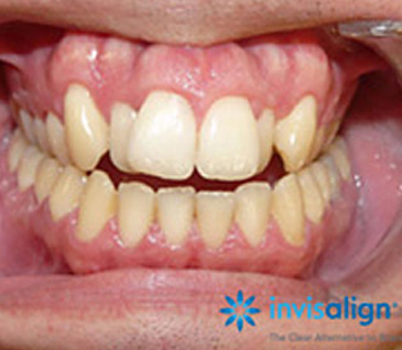 case1 before